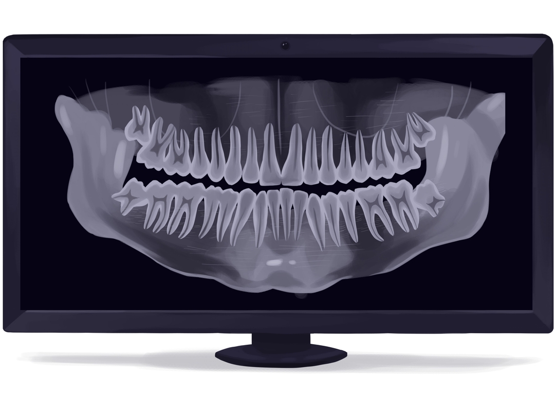 How Much Do Dentures Cost In 2024 Authority Dental   Panoramic Dental X Ray Digital Technical Picture 50777020556 O 