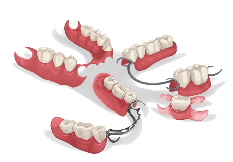 fixing broken partial dentures